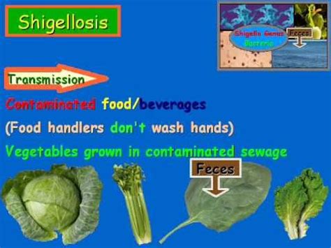 Shigellosis Overview - YouTube