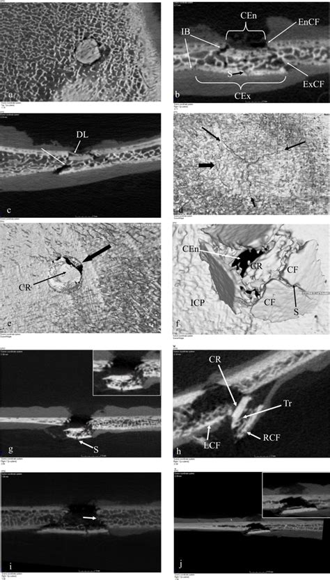 Bioceramic conoid morphology. a–d Intact conoid produced by a 57 m/s... | Download Scientific ...