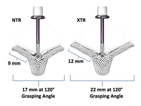 Design, Development, and Clinical Experience of Four MitraClip™ Device Generations - Cardiac ...