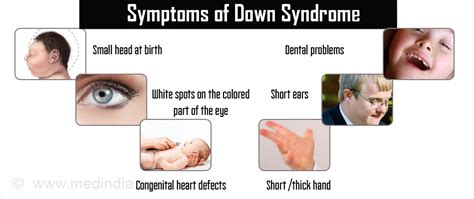 Down syndrome