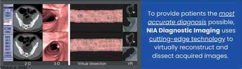 CT Colonography vs Colonoscopy – GP Voice