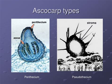 PPT Introduction To Ascomycota Continued Archiascomycetes And 30500 | Hot Sex Picture