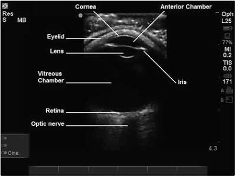 Ultrasound Anatomy