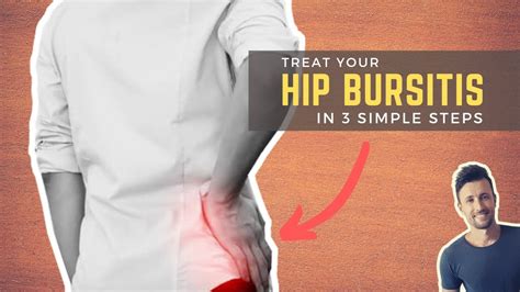 Fix Hip Bursitis In Simple Steps Bursitis Hip Bursitis Hips | The Best ...