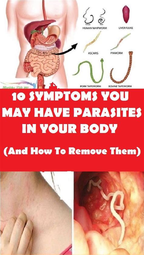 10 Symptoms You May Have Parasites in your Body (And How To Remove Them)! - Healthy Life ...