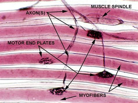 Neuromuscular-junction | Neuromuscular junction, Skeletal muscle, Histology slides