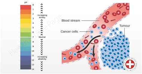 Cancer Patients Have too Acidic pH Levels. Learn How to Check Yours