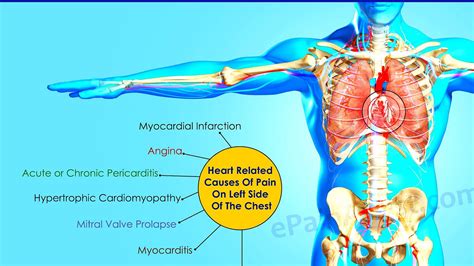 Treatment For Heart Pain - Hear Choices