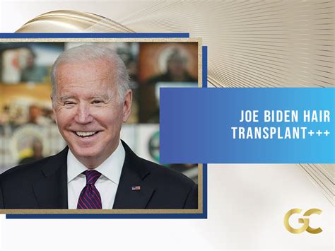 JOE BIDEN HAIR TRANSPLANT - Gold City Best Hair Transplant Turkey