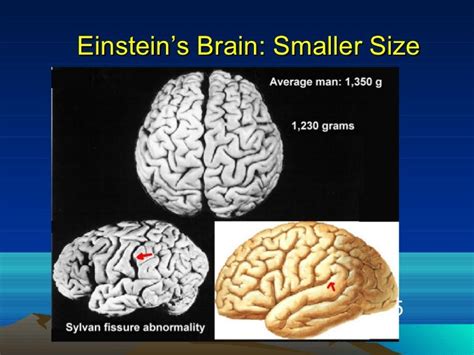 Einsteins brain