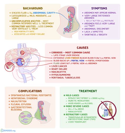 Ascites: příčiny a léčba - Zdravé jídlo v mém okolí