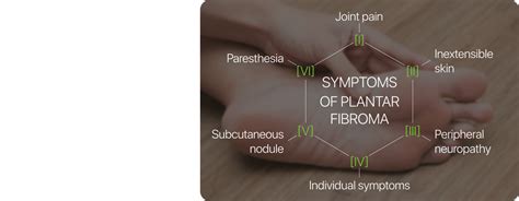 Plantar Fibroma Treatment, Symptoms, and Causes | Mega Aid