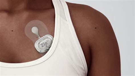 Home heart monitoring effective for detecting irregular heart rhythm ...