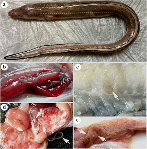 Detection of ascaridoid nematode parasites in the important marine food-fish Conger myriaster ...