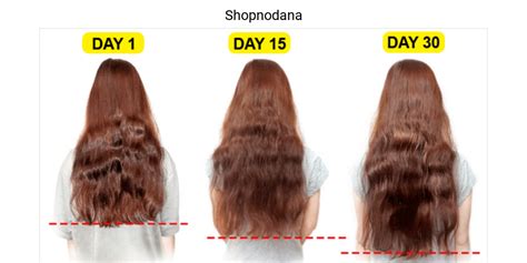 Vitamins for hair growth and stop hair fall immediately - Shopno Dana