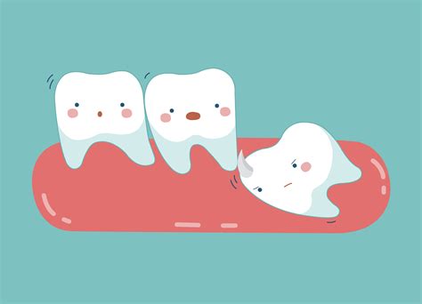 Wisdom teeth removal explained by a dentist in Armadale