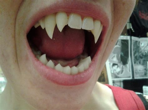 Custom Fangs and Vampire Teeth Orders and Sales