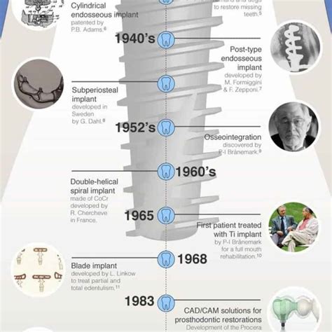 Brief Dental Implant History Infographic - Teeth FAQ Blog