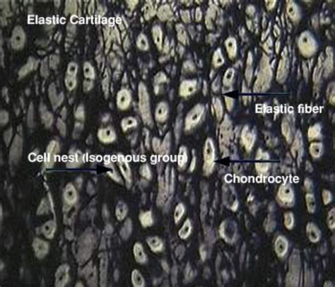 connective tissue cartilage