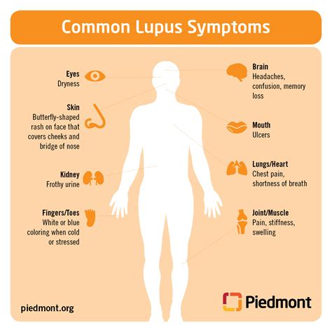 Lupus Causes, Symptoms and Treatment Information | Piedmont Healthcare