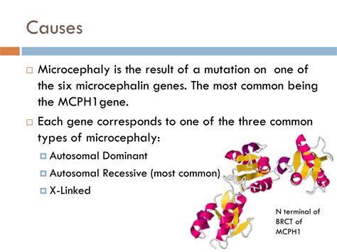 PPT - MICROCEPHALY PowerPoint Presentation, free download - ID:3780061