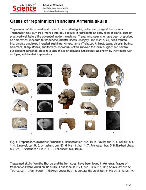 (PDF) Cases of trephination in ancient Armenia skulls // Atlas of ...