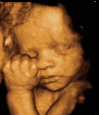 Ultrasound Photo Gallery, 3D Photos by Week. Statesville NC Sonogram