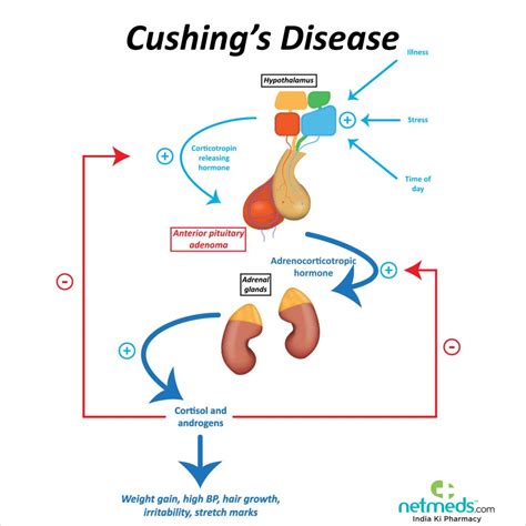 Understanding Cushing Syndrome: Causes, Symptoms, And, 47% OFF