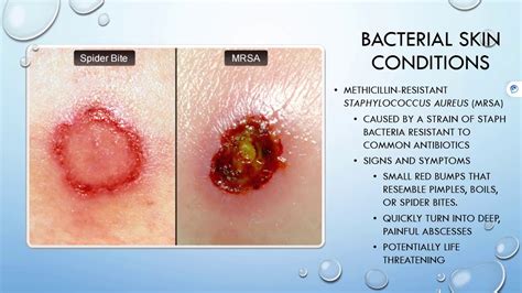 Dermatology Conditions