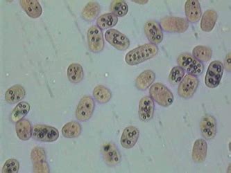 purple sulfur bacteria | Quimica organica, Química