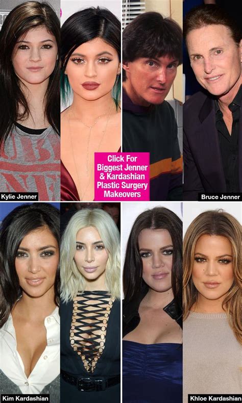 Kardashians before and after photos