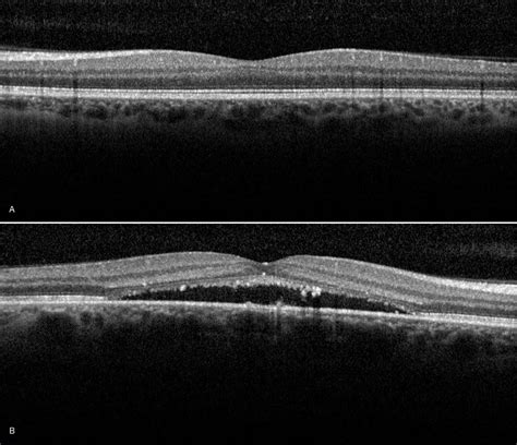 Leading Technology - Retina & Eye Consultants