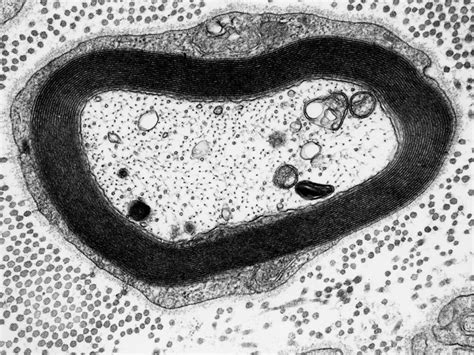 Myelinated Axon Histology