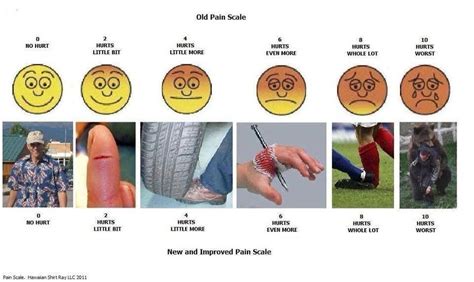 New and improved pain scale | Job Humor | Pinterest