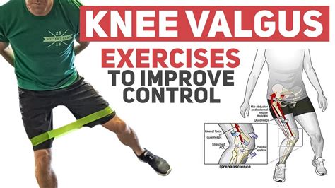 Knee Valgus - Rehab Exercises to Improve Movement Control - YouTube