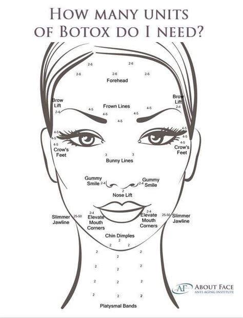 Diagram Botox Lip Flip Injection Points Diagram Botox Lip Fl