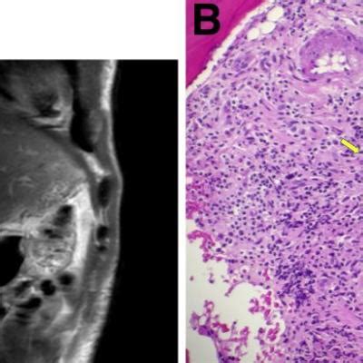 What is the diagnosis? | GI and Hepatology News