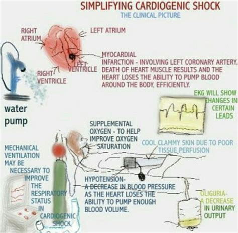 Cardiogenic shock | Nursing school survival, Nurse, Emergency nursing