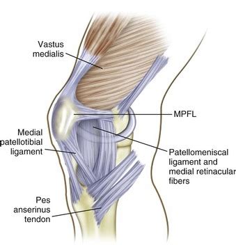 MPFL Reconstruction | SSOR Physical Therapy