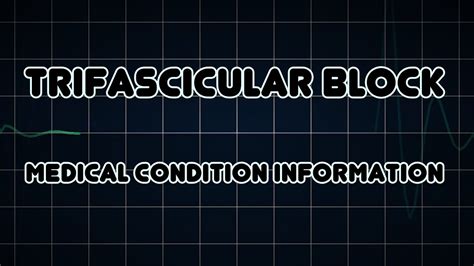 Trifascicular block (Medical Condition) - YouTube