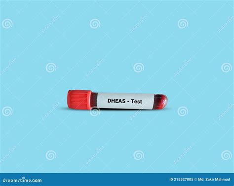 Test Tube with Blood Sample for DHEAS Test. Stock Image - Image of ...