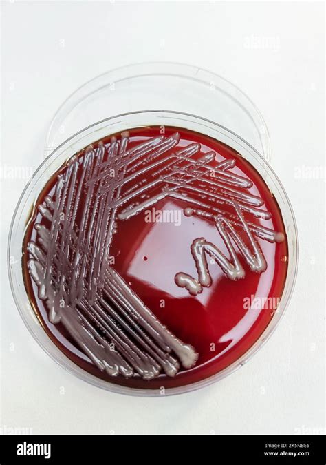 A MRSA staphylococcus aureus bacteria displayed on a blood agar plate on white surface Stock ...