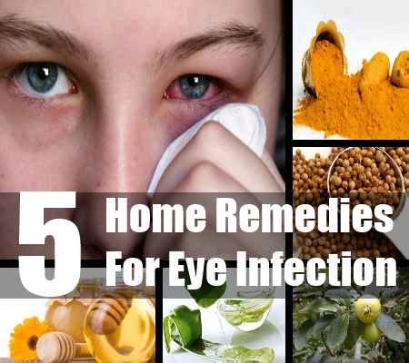 Home Remedies For Eye Infection - Natural Treatments And Cure For Eye ...