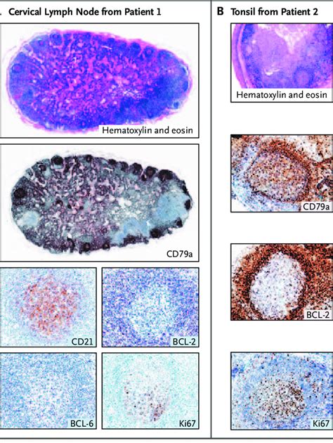 Germinal Center Lymph Node