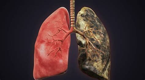 WATCH: Lungs of smokers vs non-smokers; this viral video shows the real picture | The Indian Express