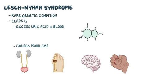 Lesch-nyhan syndrome - MEDizzy