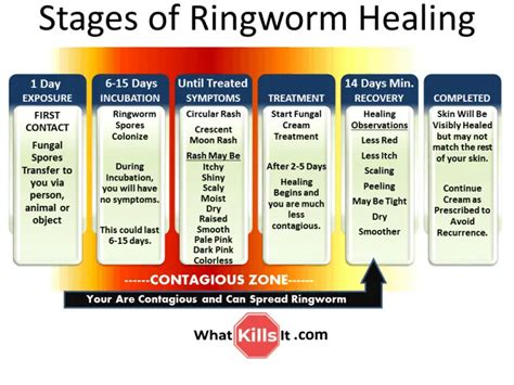 Stages of Ringworm Healing - See What Stage You're In and What's Next