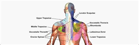 Trigger Point Injection - Texas Back Institute