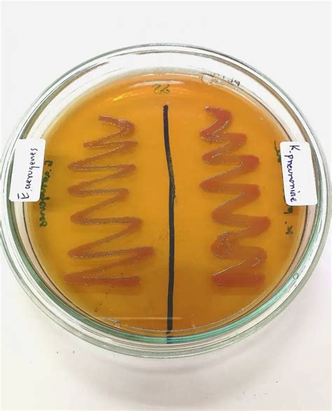 Enterobacter Cloacae: Facts, Symptoms, Treatment | STD.GOV Blog