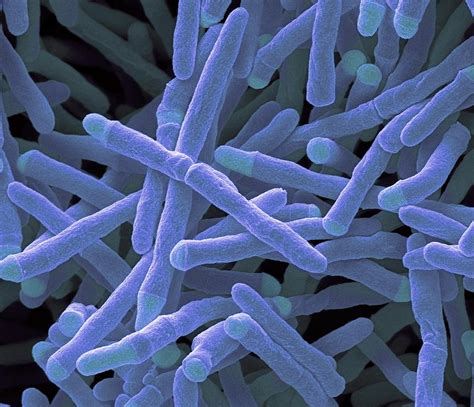 Mycobacterium Smegmatis Gram Stain